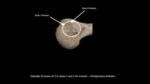 U2.31.1081 R humerus Posterior view with caption.png by Lesley A. Gregoricka